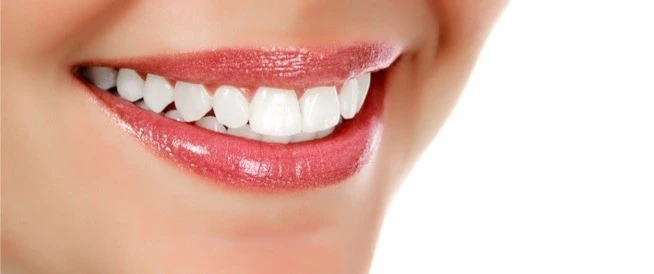 ابتسامة هوليود